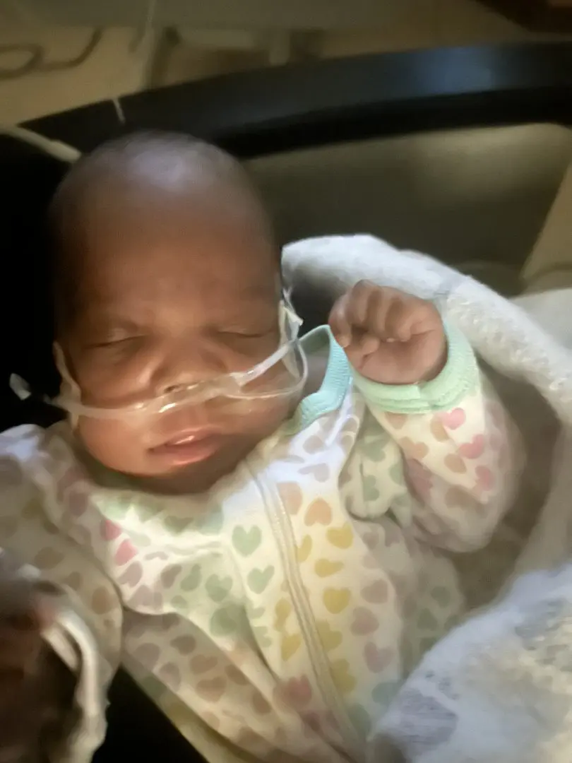 sleeping baby with oxygen tube