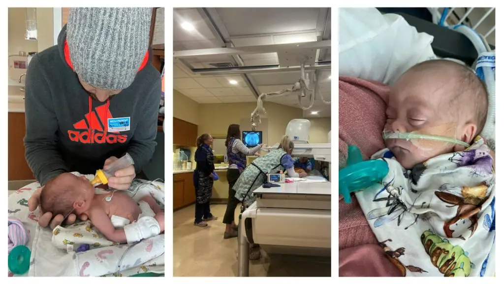 The Care that Carried Oliver. Oliver needed surgery his first day of life.