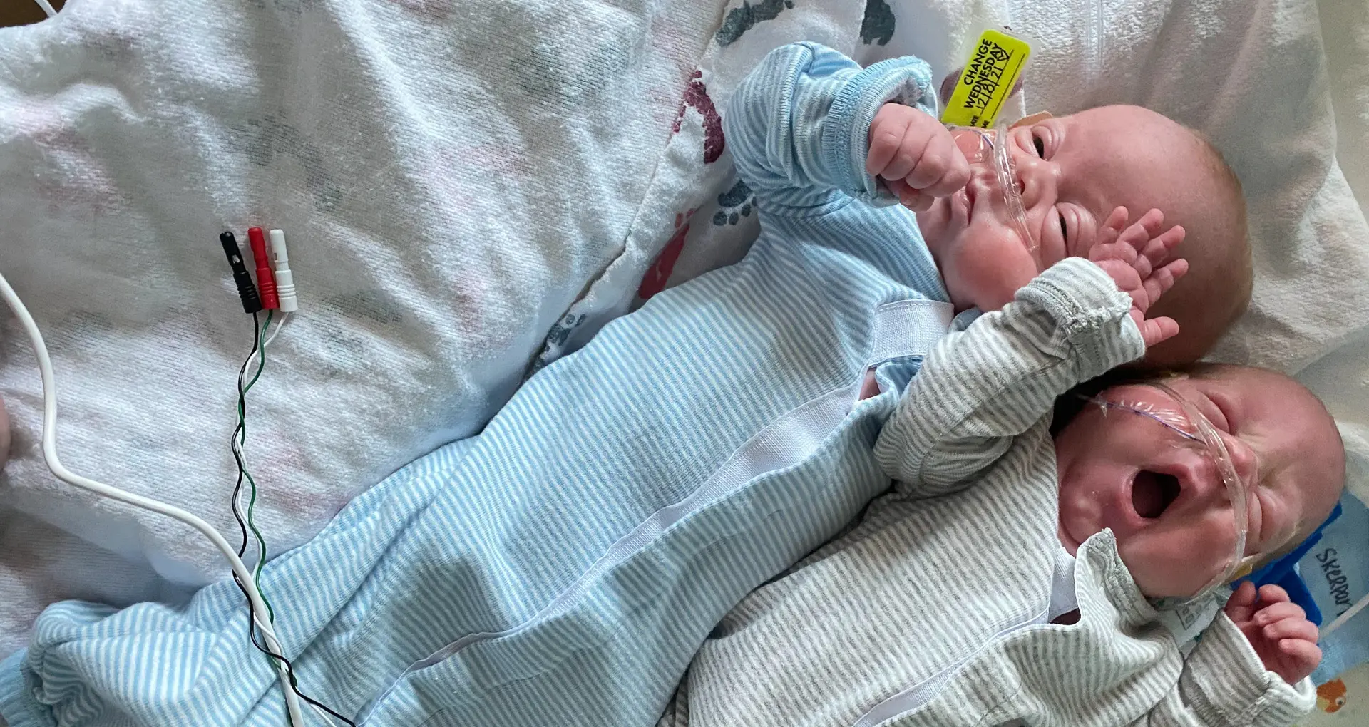 two babies with oxygen tubes in laying in bed together