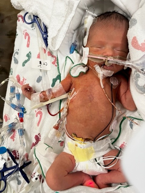 a tiny baby at the hospital